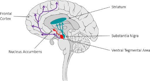 parkinson1