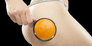 Cellulite & Falten - Was hilft wirklich?