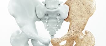 Aminosäuren u.a. gegen Osteoporose